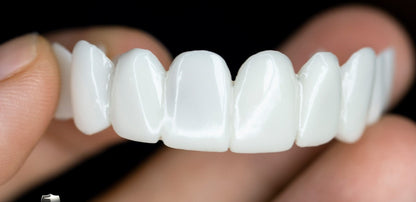 Cosmetic Snap-On Tooth Cover