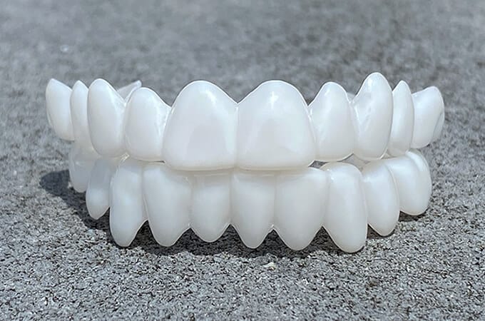 Cosmetic Snap-On Tooth Cover