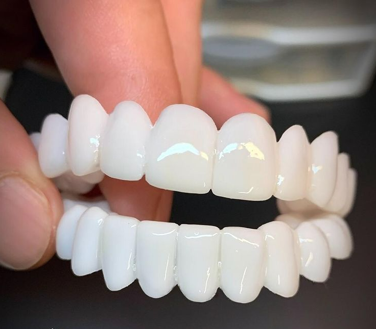 Cosmetic Snap-On Tooth Cover