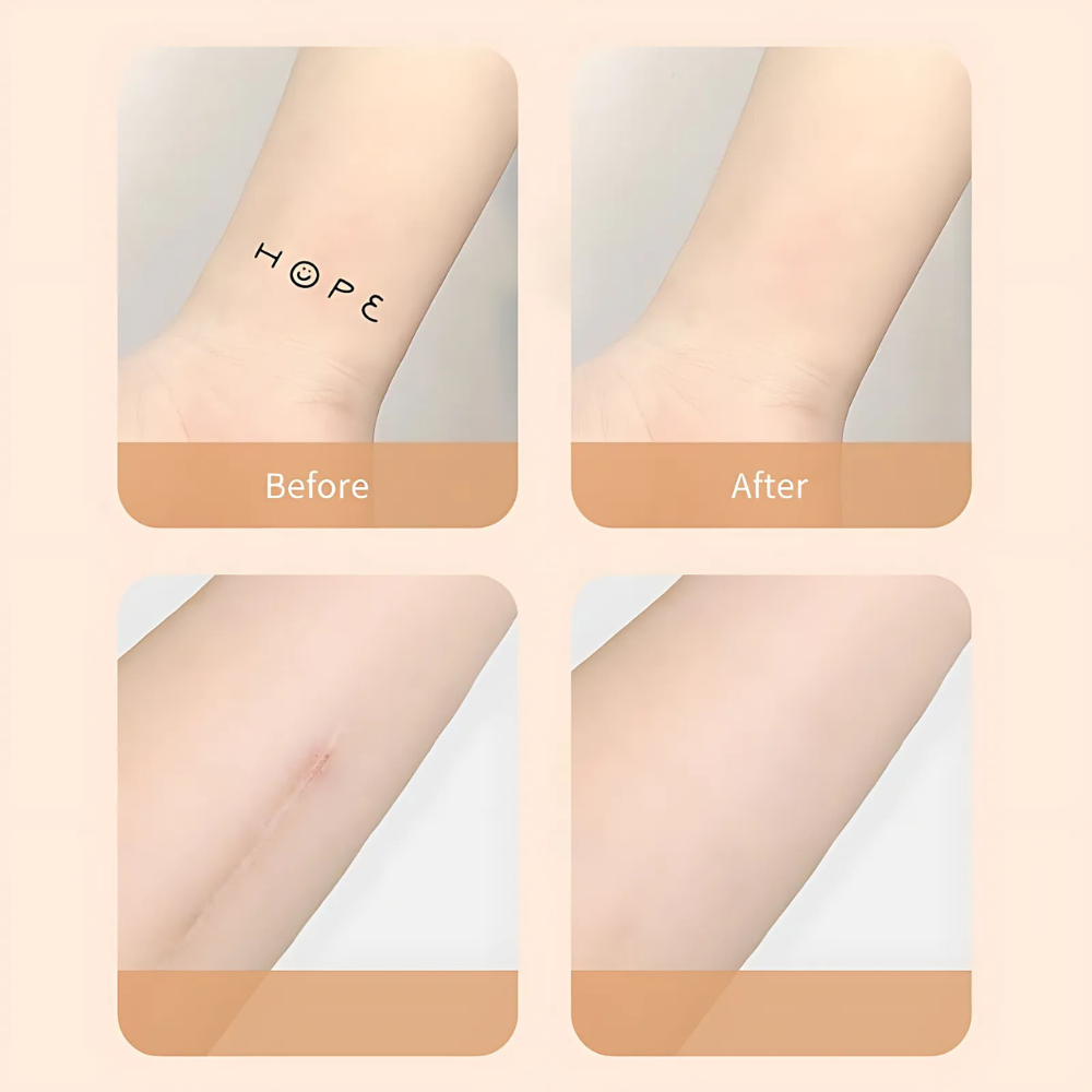 Scar Concealer Patch
